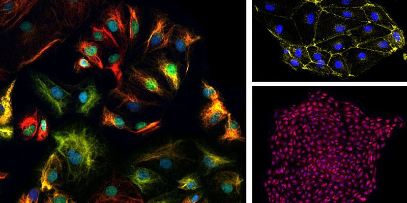 UMA-celulas-cardiacas opt